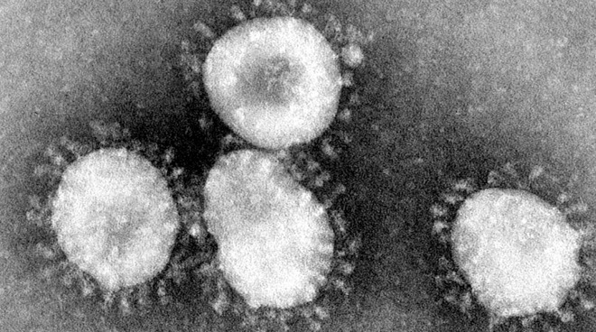 Electron micrograph of coronavirus virions